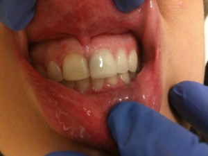 Woman's Smile Before Dental Treatment Case #3