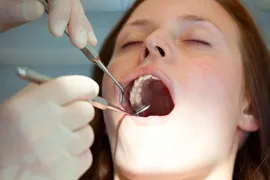 A woman getting a professional teeth cleaning